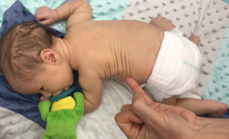 Primary Infant Reflexes Part 2